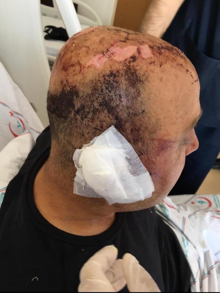 Eskişehir’de telsizle dövülen polis memuru: Gözlerimi hastanede açtım
