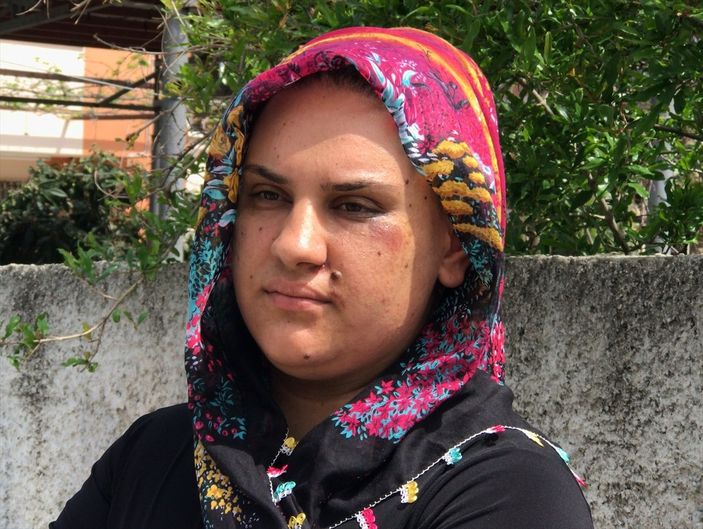 a Adana'da iki kardeşi yerde sürükleyen kapkaç zanlısı yakalandı