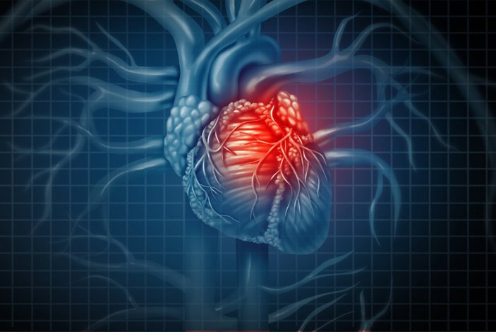 Kalp krizi geçirdiğinizi nasıl anlarsınız? Geçirilmiş kalp krizi belirtileri..