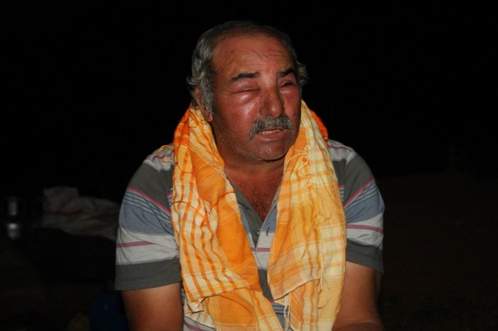 Antalya'da arı saldırısına uğrayan çoban: İnsanlar dışarı çıkamaz oldu