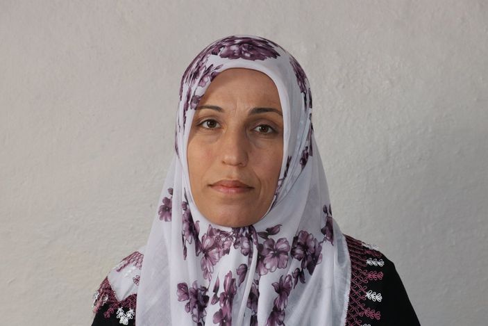 Mardin'de yaşayan hidrosefali hastası için Sağlık Bakanı devreye girdi