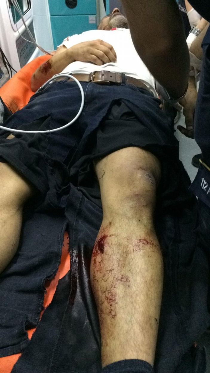 bıçaklı saldırı