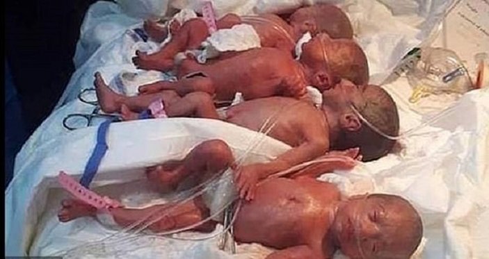 Fas'ta bir kadın doğum yaptı, 9 çocuk dünyaya geldi