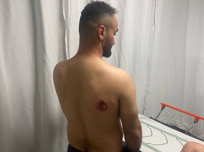 AA’nın Ortadoğu Editörü, Mescid-i Aksa saldırısında yaralandı