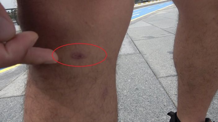 Mersin'de yılan saldırısına uğrayan bisikletli