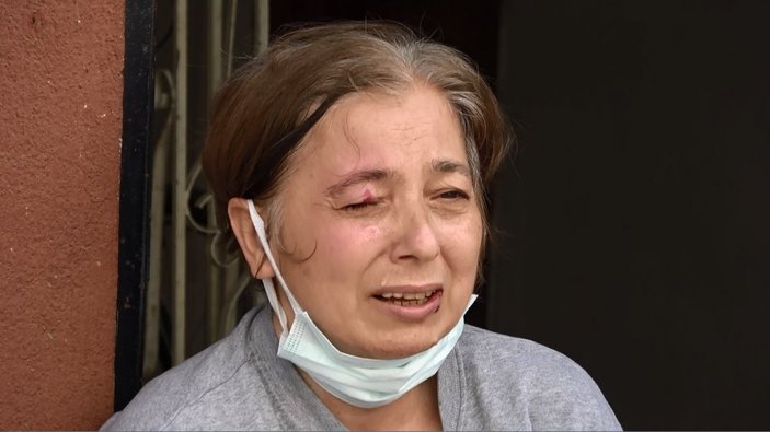 Sultangazi'de sokağa atılan maytap yoldaki kadını yaraladı
