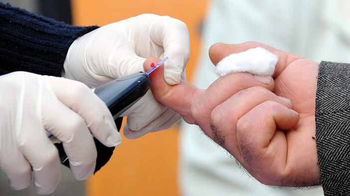 Bağışıklık ve doğal zayıflama için: Yeşil Çay