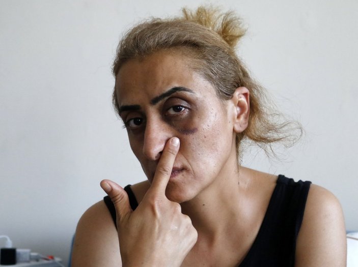 Antalya’da şiddet gören kadın: Ensemde ölüm kokusu alıyorum