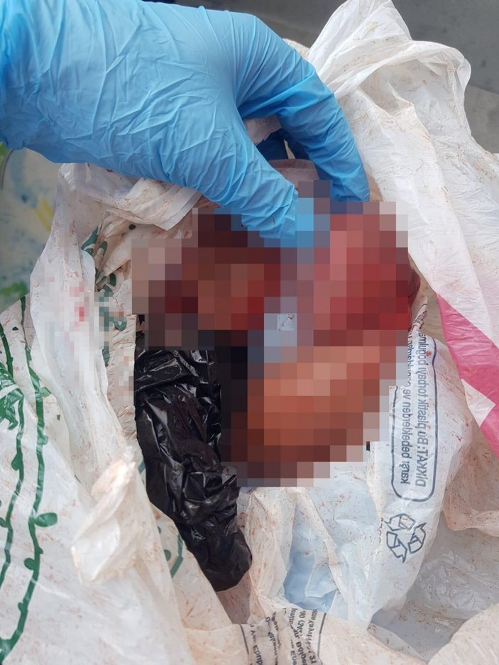 Antalya’da düşük yapan kadın bebeğini çöpe attı