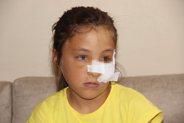 Erzurum'da 10 yaşındaki kuzenine demir boruyla saldırdı