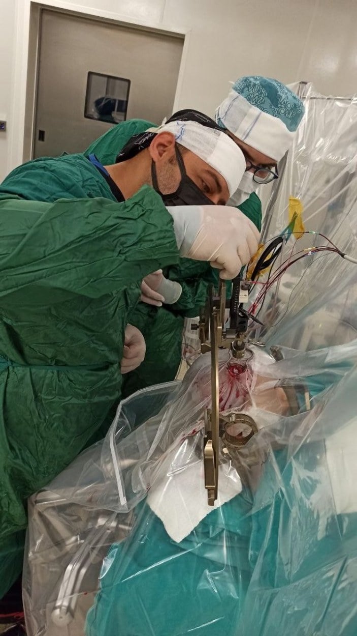 Elazığ'da çocuk hastaya uyanıkken beyin pili takıldı