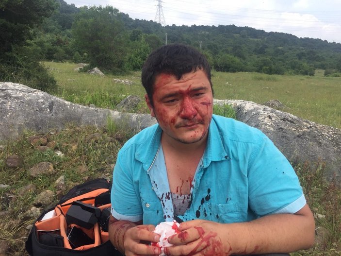 Saldırıya uğrayan İHA muhabiri Mustafa Uslu, görevinin başına döndü
