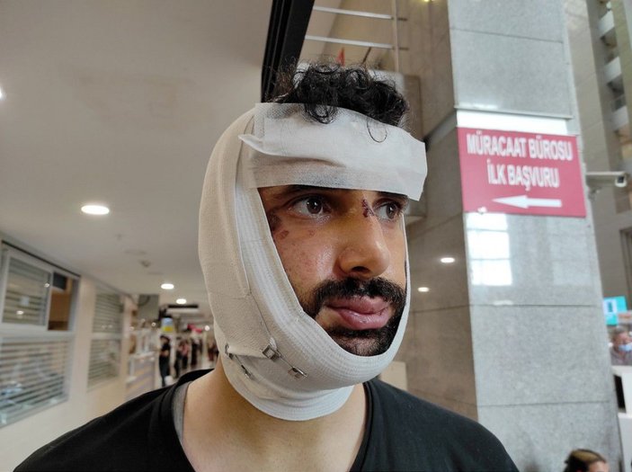 AA muhabiri Ekrem Biçeroğlu'na saldıran şüpheliler serbest bırakıldı