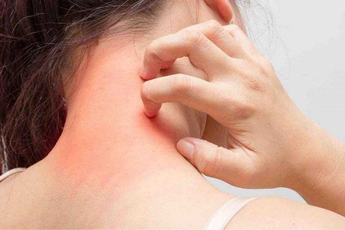 Anafilaksi nedir, belirtileri nelerdir? Anafilaksi hastaları aşı olabilir mi?