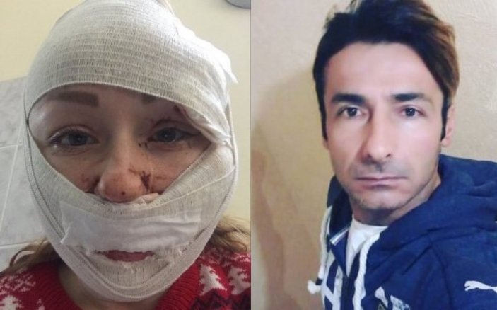 Bakırköy'de boşanmak istediği eşi tarafından falçatalı saldırıya uğrayan kadın konuştu