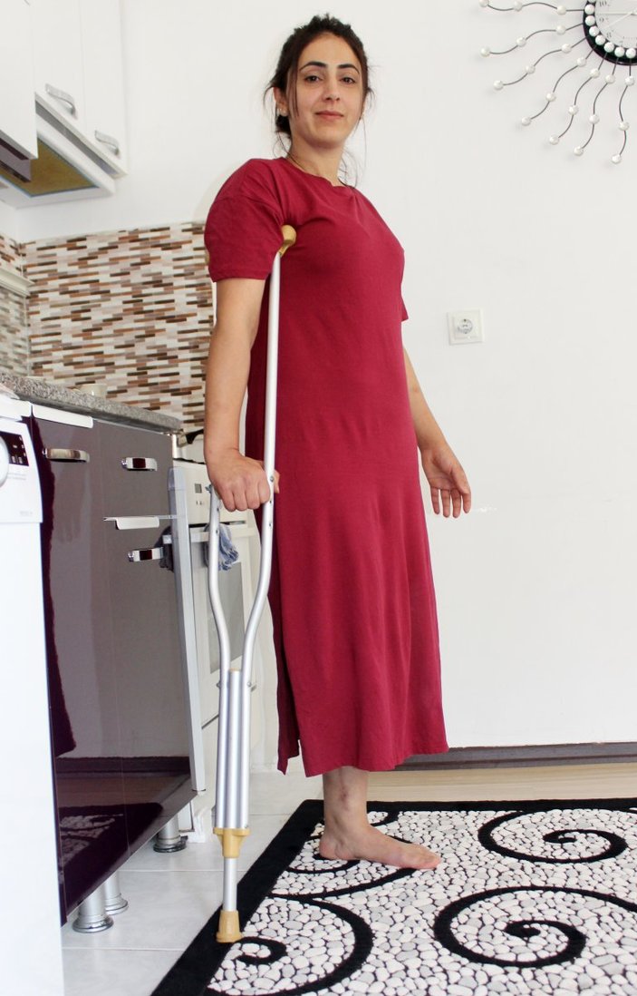 Antalya'da eşinin saldırısına uğrayıp bacağını kaybetti: Ölmek istemiyorum