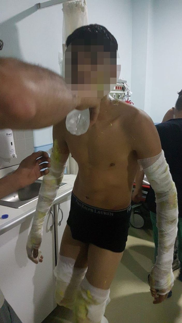 i Arnavutköy'de konteynerde çakmak gazı patladı: 3 yaralı