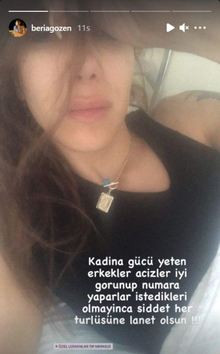 Survivor yarışmacısı hakkında darp iddiası! Sevgilisini dövdü, yastıkla boğdu...