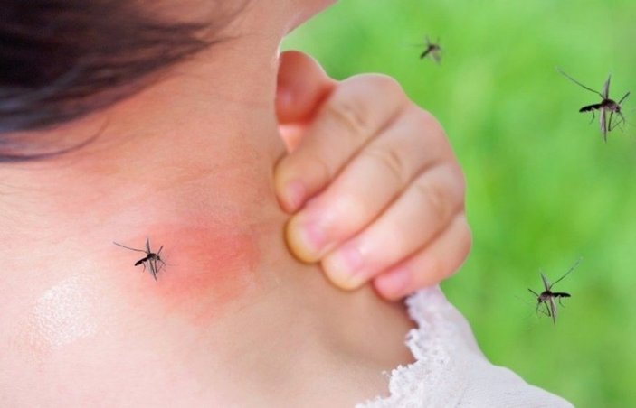 Yaz aylarında en sık görülen alerjiler