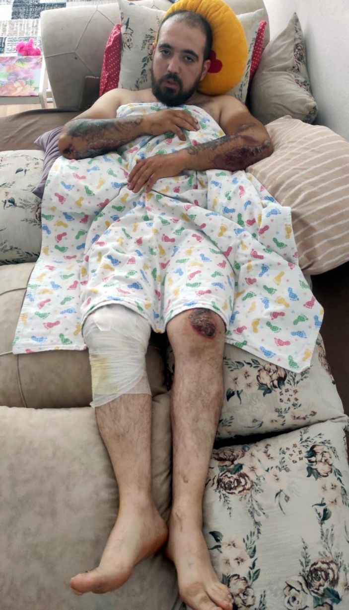 Ankara'da kamyon sürücüsünün çarptığı motosikletli konuştu