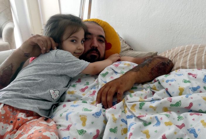 Ankara'da kamyon sürücüsünün çarptığı motosikletli konuştu