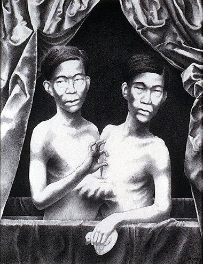 Tek bedende iki arzu: Siyam İkizleri Chang ve Eng Bunker’in hikayesi