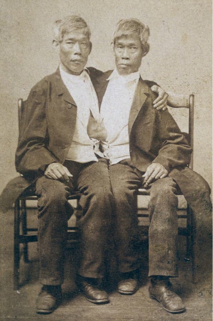 Tek bedende iki arzu: Siyam İkizleri Chang ve Eng Bunker’in hikayesi