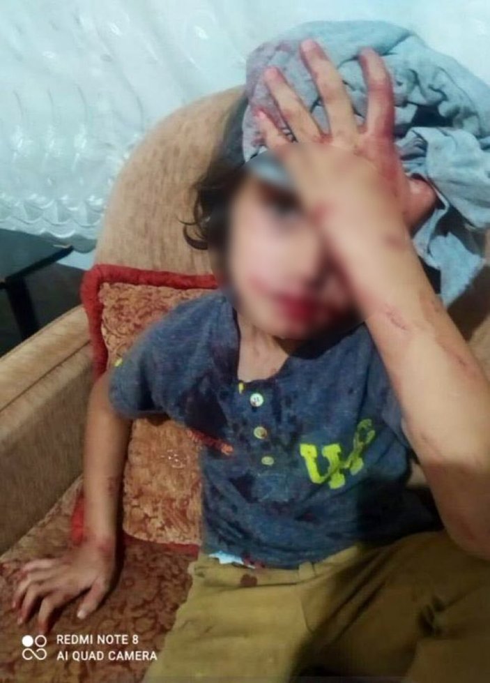 Ankara’daki saldırıda yaralanan çocuk tedavi altına alındı