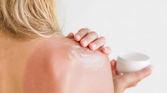 Güneş yanıklarından korunmak için 5 ipucu