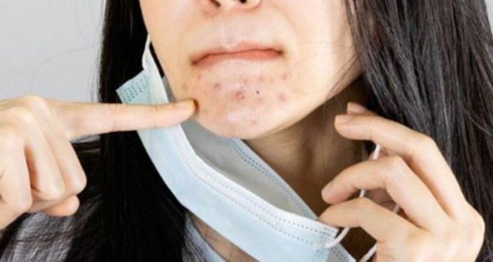 Doğal antibiyotik: Balın sağlığa faydaları