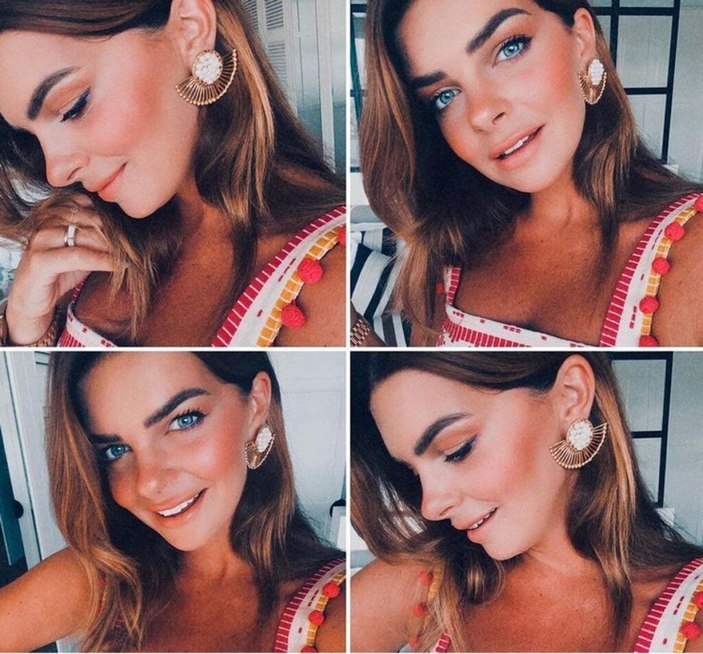 Pelin Karahan 'estetik' güzeli mi? Yüzündeki değişim dikkat çekti..