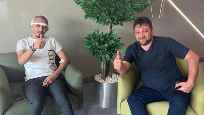 Saç Ekimi ile Doğal Görünümlü Saçlara Kavuşun