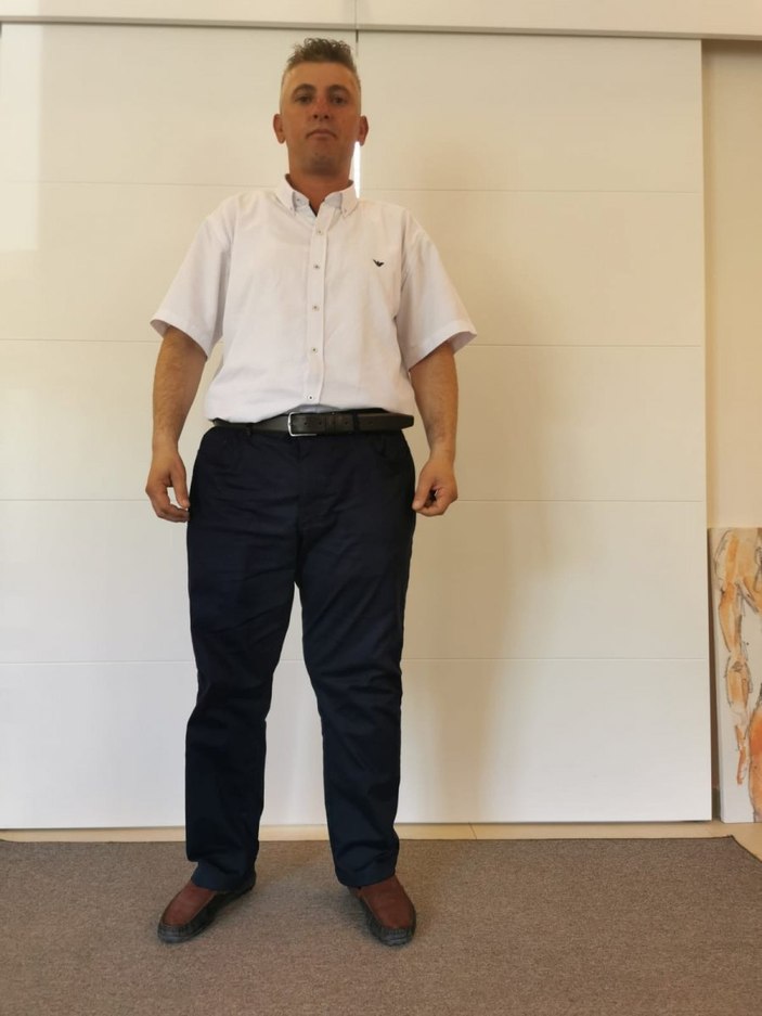 Ispartalı Hakan’ın bedeninden tam 35 kiloluk kitle çıktı