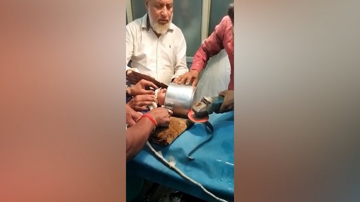 Hindistan’da çocuk, başını düdüklü tencereye sıkıştırdı