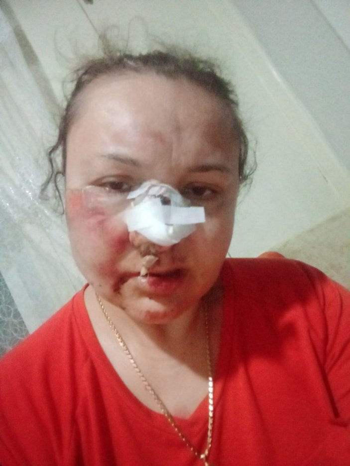 Gaziantep'te eski erkek arkadaştan şiddet
