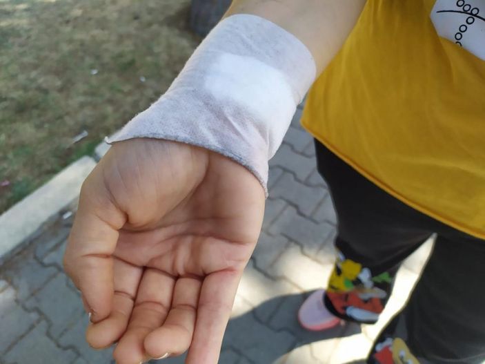 i Gaziantep'te bir kadın, boşanmak istediği eşi tarafından darbedildi