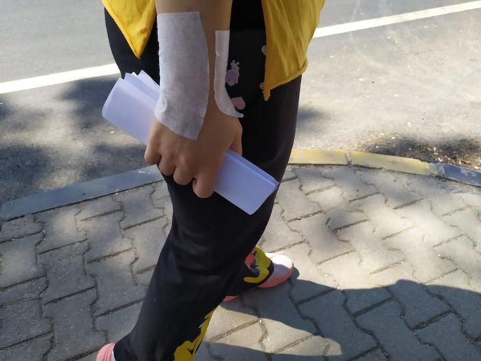 i Gaziantep'te bir kadın, boşanmak istediği eşi tarafından darbedildi