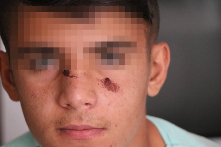 Aksaray’da, kız kardeşinin videosundaki 13 yaşındaki çocuğu öldüresiye dövdü