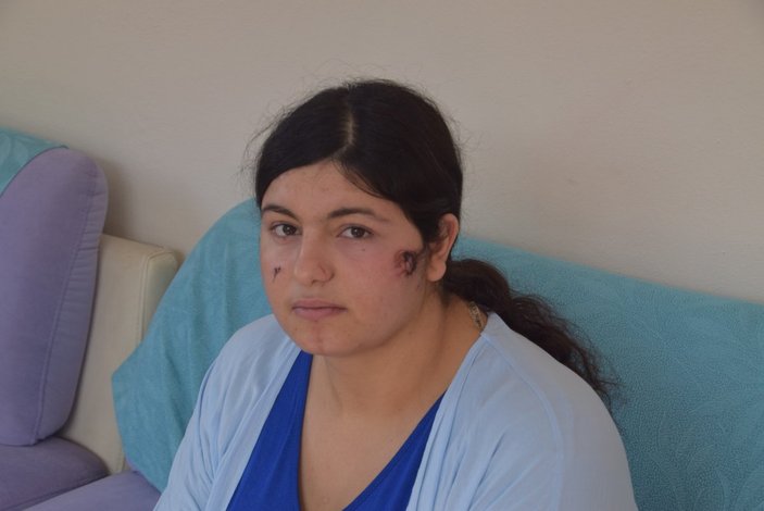 İzmir'de kocası tarafından darbedilen kadın o anları anlattı