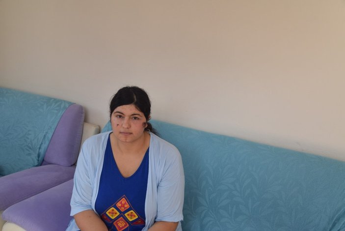 İzmir'de kocası tarafından darbedilen kadın o anları anlattı