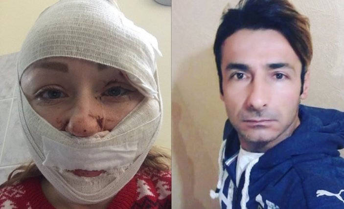 Bakırköy'de eşini falçata ile yaralayan sanığa 11 yıl 8 ay hapis cezası