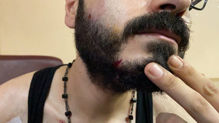 İstanbul’da kuaförde bıçaklı saldırı yaşandı