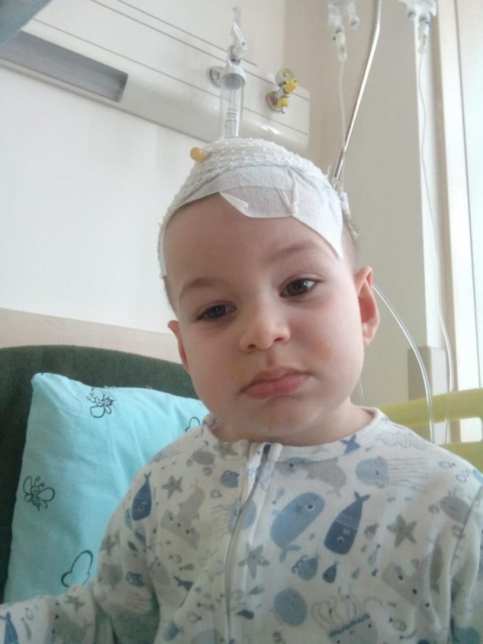 Ümraniye'de 3 yaşındaki Arif, beynindeki tümörle mücadele ediyor