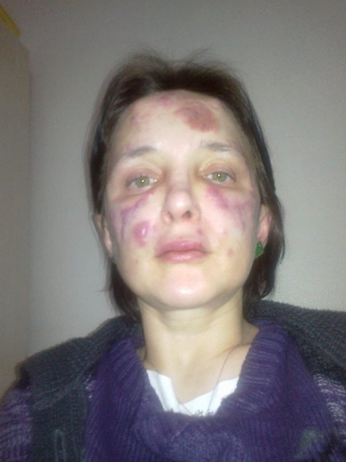 Bakırköy’de kadını tanınmaz hale getiren sahte doktora 3 yıl 4 ay ceza
