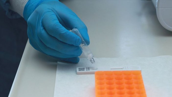 Almanya’da, koronavirüs testleri ücretli oldu