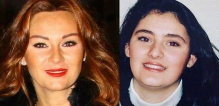 Pınar Altuğ'un estetiksiz hali görenleri şoke etti! Resmen bambaşka biri