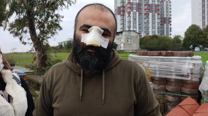 Samsun’da tasmasız pitbull, Azerbaycanlı iş insanının burnunu kopardı
