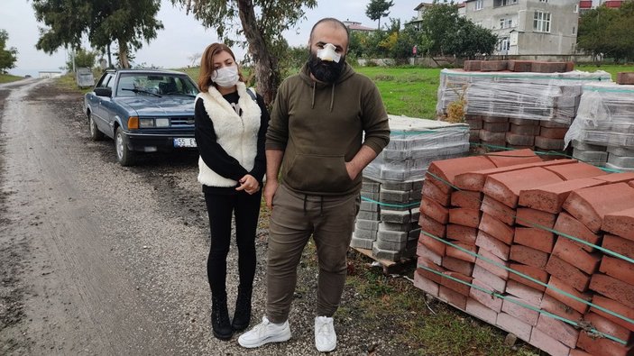 Samsun’da tasmasız pitbull, Azerbaycanlı iş insanının burnunu kopardı