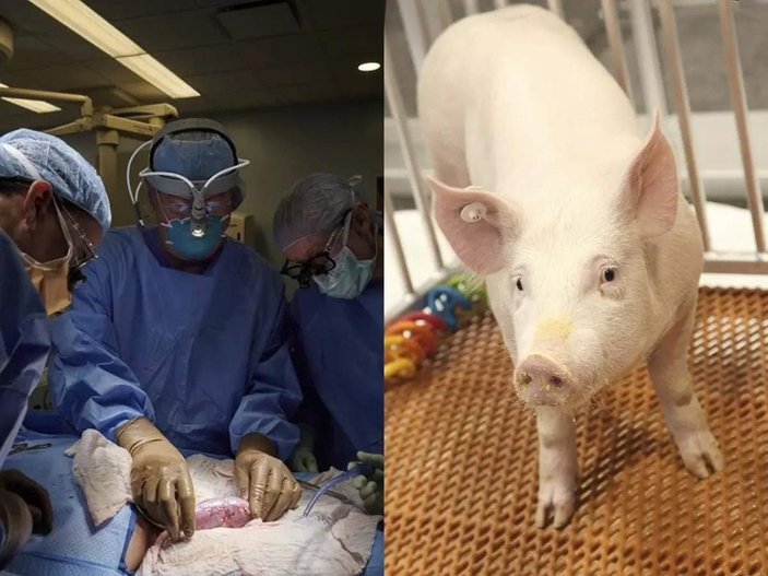 Dünyada bir ilk: Genetiğiyle oynanmış bir domuzun böbreği insana nakledildi