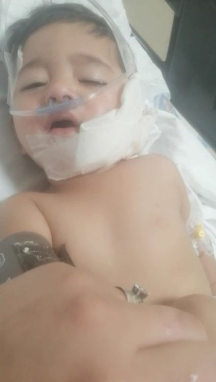 Antalya’da pitbull, 11 aylık bebeğe ve babasına saldırdı